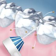 Wie verwendet man Oral-B Aqua Care?