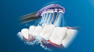 Philips Sonicare-Technologie