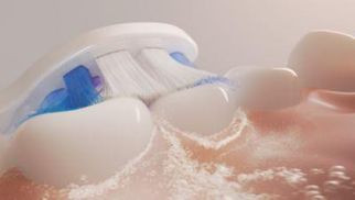 Zuverlässige Zahnreinigung mit Sonicare