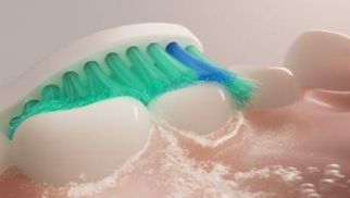 Zuverlässige Zahnreinigung mit Sonicare