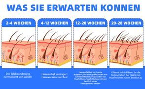 Fördert sicher und effektiv das Haarwachstum