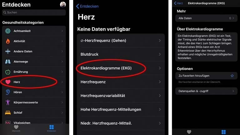 Apple-Watch-EKG einrichten: Mit der Health-App auf dem iPhone