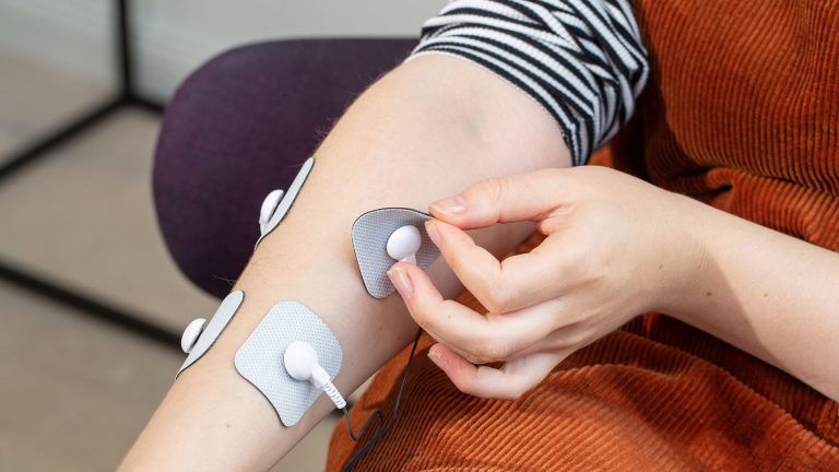 Beurer EM 49 Eine Person klebt die Elektroden eines TENS-Gerätes auf ihren Arm auf.