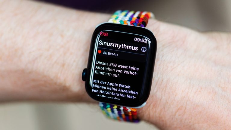 Eine Person hält das Ergebnis der EKG-Messung der Apple Watch in die Kamera.